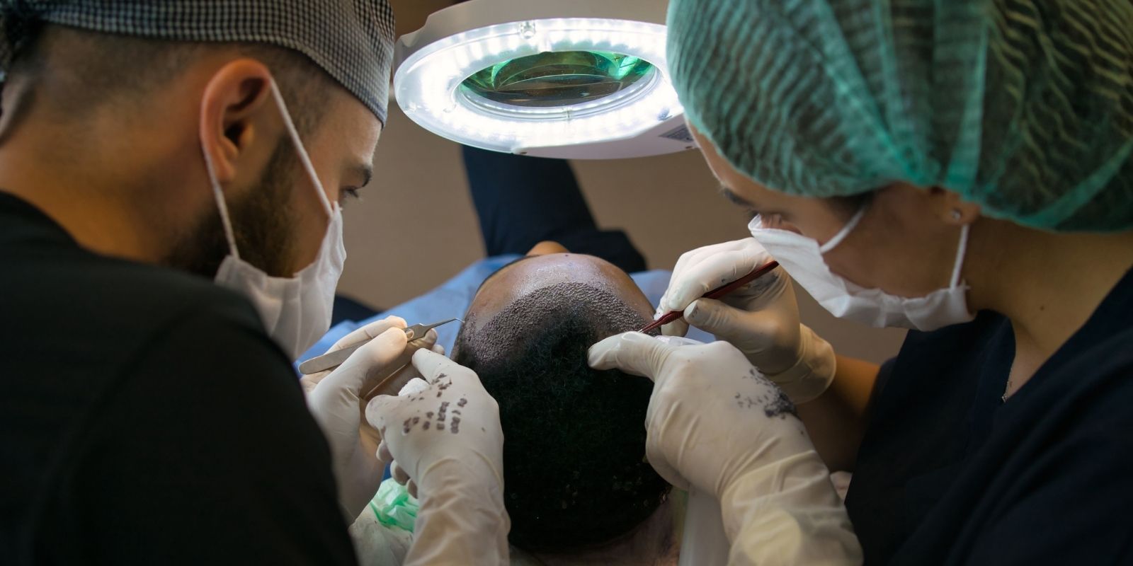 a hair transplant operation in a hospital
